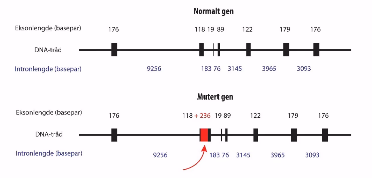 Eksoner og introner for det normale genet (øverst), og eksoner og introner for det muterte genet (nederst). Den innsatte DNA-sekvensen er merket rød
