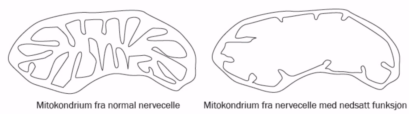 Mitokondrium fra en normal nervecelle og fra en nervecelle med nedsatt funksjon.